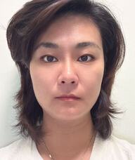 Book an Appointment with Ping (Joyce) Xiao for Acupuncture